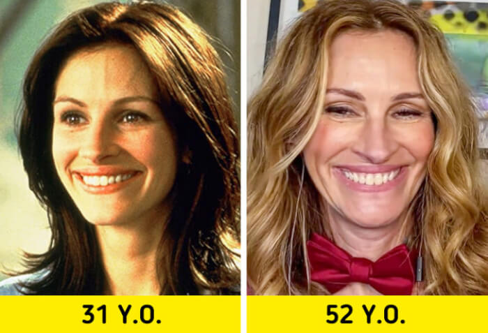 11 Famous People Refusing Cosmetic Surgery In Favor Of Their Natural Appearance