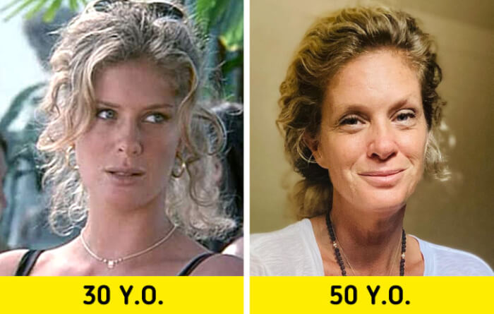 11 Famous People Refusing Cosmetic Surgery In Favor Of Their Natural Appearance