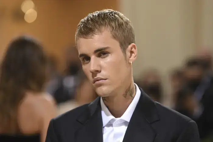 Justin Bieber Cancels Shows1 -Justin Bieber Cancels Shows, Revealing Half His Face Paralyzed By Virus