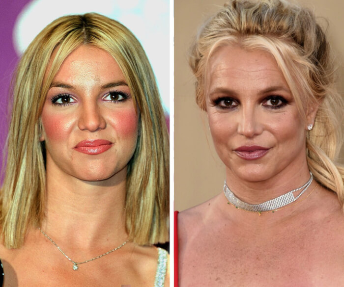 15 Most Dramatic Changes Of Celebrities That Make You Say No Way11 -15 Most Dramatic Changes Of Celebrities That Make You Say “No Way”