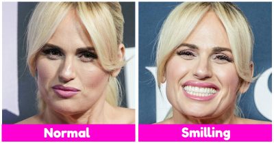8508 -19 Celebrities With Dazzling Smiles That Will Lighten Partly Your Bad Day