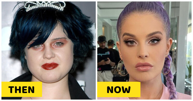 8576 -15 Most Dramatic Changes Of Celebrities That Make You Say “No Way”