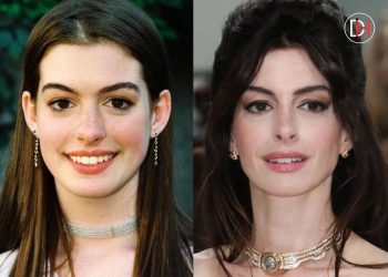 Anne Hathaway’s Captivating Transformation: A Tale of Beauty, Talent, and Triumph