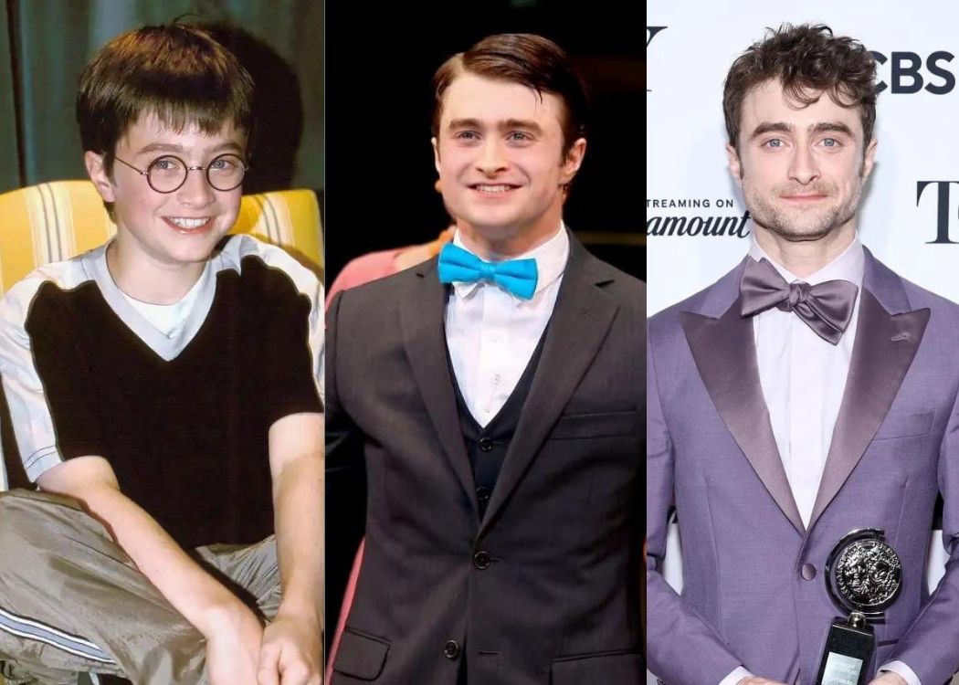 See Daniel Radcliffe'S Transformation Over The Years: From Wizard To Broadway Star