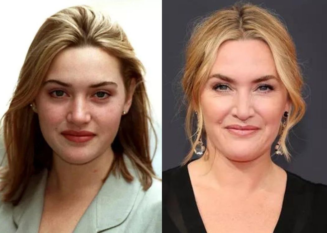 How Much Kate Winslet’s Beauty Evaluated From The ‘90S To Now