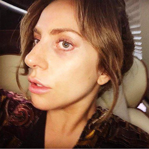 A Glimpse Into Lady Gaga'S Daily Life: Embracing Natural Beauty And Heartwarming Moments With Children