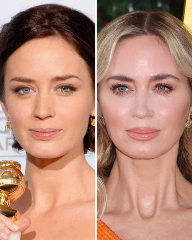 Emily Blunt’s Stunning Transformation: See Her Beauty Evolution Over The Years