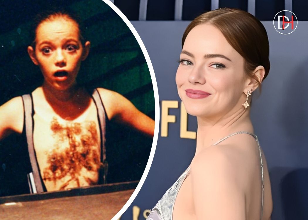 Emma Stone'S Remarkable Change Over The Years That Will Leave You In Awe