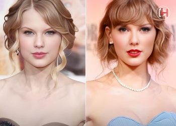 Taylor Swift’s Transformation: The Truth Behind The ‘Chronic’ Surgery Speculation