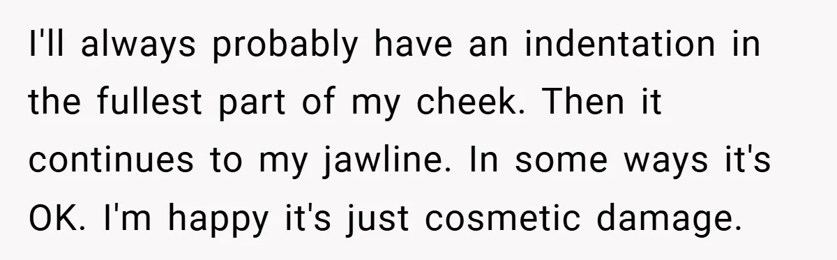 I'll always probably have an indentation in the fullest part of my cheek. Then it continues to my jawline. In some ways it's OK. I'm happy it's just cosmetic damage.