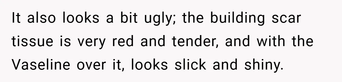 It also looks a bit ugly; the building scar tissue is very red and tender, and with the Vaseline over it, looks slick and shiny.