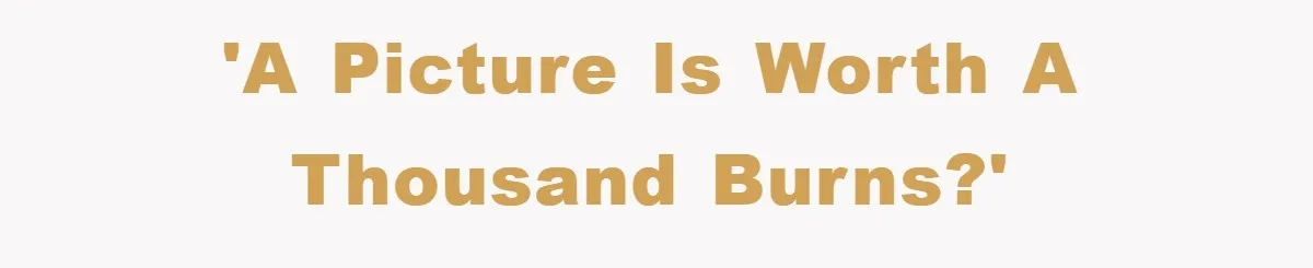 'A picture is worth a thousand burns?'