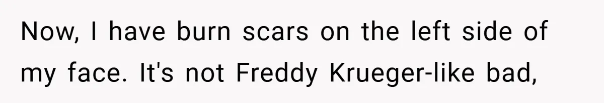 Now, I have burn scars on the left side of my face. It's not Freddy Krueger-like bad,