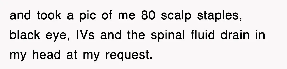 and took a pic of me 80 scalp staples, black eye, IVs and the spinal fluid drain in my head at my request.