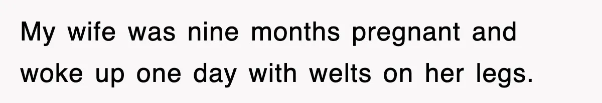 My wife was nine months pregnant and woke up one day with welts on her legs.