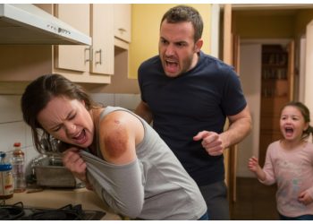 Husband Blames Stepmom for Hurting Daughter's Feelings After She Gets Burned Husband Blames Stepmom for Hurting Daughter’s Feelings After She Gets Burned