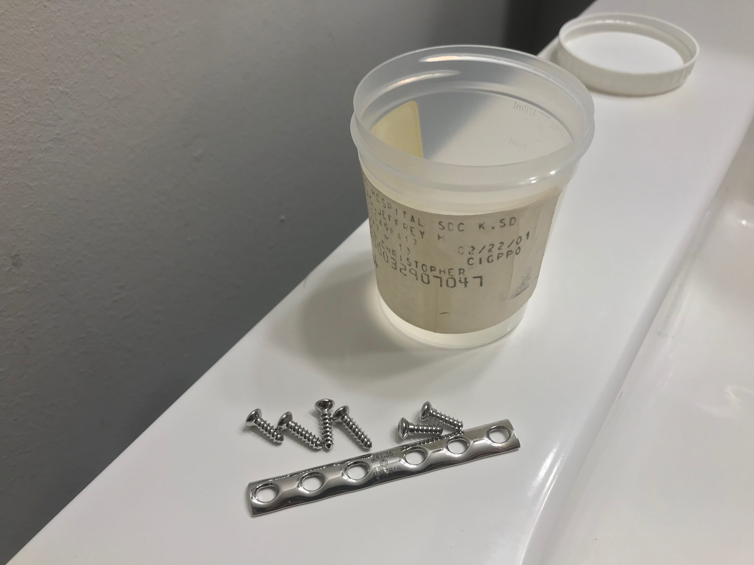 Teen Breaks Arm In Half, Nurse Doesn’t Believe Him So He Bends It To Prove It