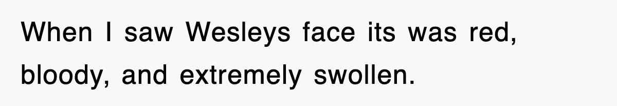 When I saw Wesleys face its was red, bloody, and extremely swollen.