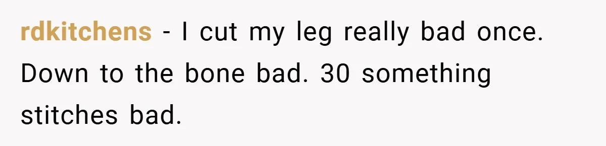 rdkitchens − I cut my leg really bad once. Down to the bone bad. 30 something stitches bad.