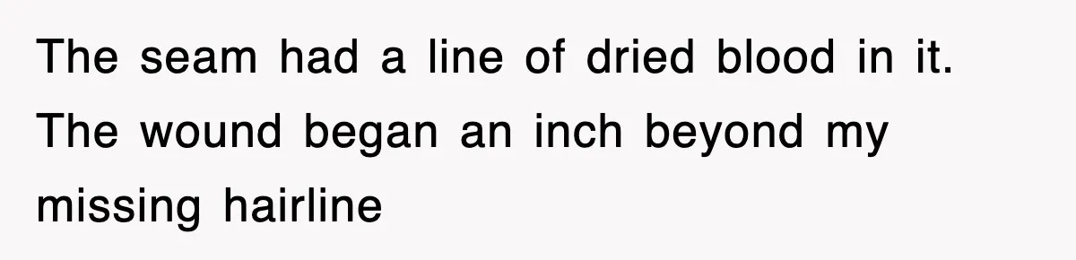 Teen Shows Up To Class With Fresh Stitches From A Brutal Car Accident, Teacher Insists No Hats, Chaos Ensues The seam had a line of dried blood in it. The wound began an inch beyond my missing hairline