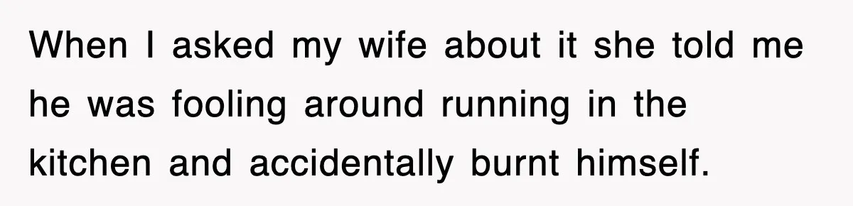 When I asked my wife about it she told me he was fooling around running in the kitchen and accidentally burnt himself.