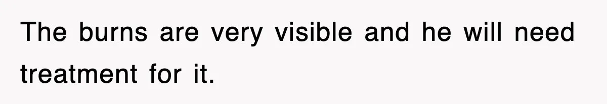The burns are very visible and he will need treatment for it.