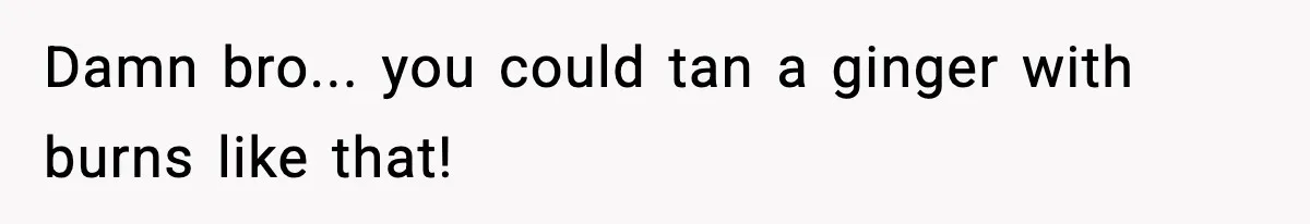 Damn bro... you could tan a ginger with burns like that!