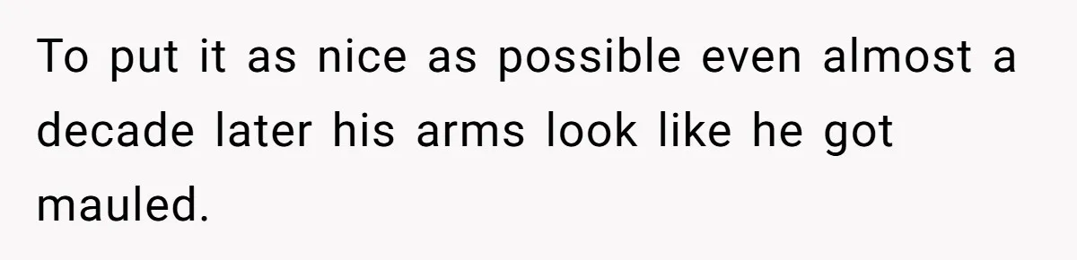 To put it as nice as possible even almost a decade later his arms look like he got mauled.
