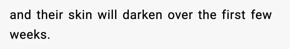 Woman Humiliates Husband's Coworker After He Calls Her Baby "Too Light" To Be His and their skin will darken over the first few weeks.
