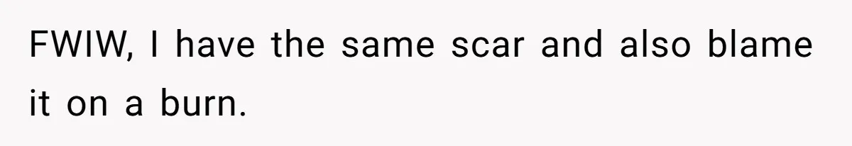 FWIW, I have the same scar and also blame it on a burn.
