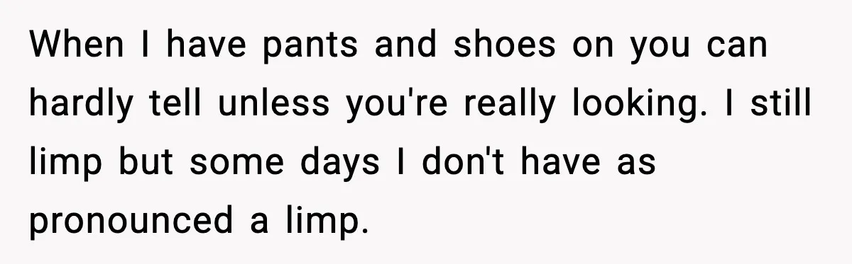 When I have pants and shoes on you can hardly tell unless you're really looking. I still limp but some days I don't have as pronounced a limp.