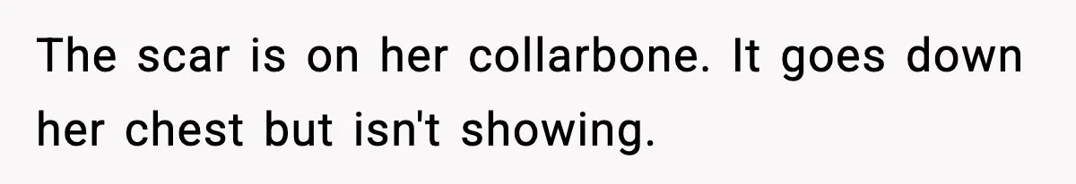 Sister Tells Bride To Cover Burn Scar, Groom Uninvites Her From The Wedding The scar is on her collarbone. It goes down her chest but isn't showing.
