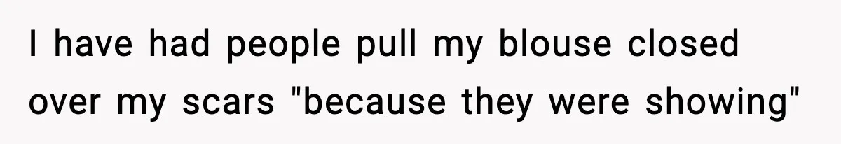 Sister Tells Bride To Cover Burn Scar, Groom Uninvites Her From The Wedding I have had people pull my blouse closed over my scars "because they were showing"