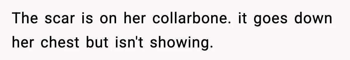 Sister Tells Bride To Cover Burn Scar, Groom Uninvites Her From The Wedding The scar is on her collarbone. it goes down her chest but isn't showing.