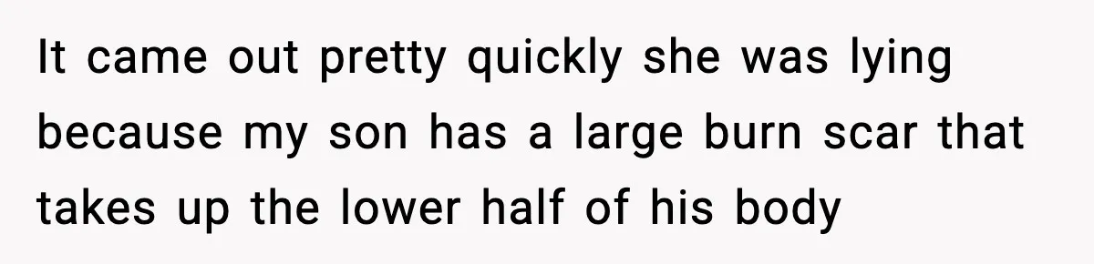 It came out pretty quickly she was lying because my son has a large burn scar that takes up the lower half of his body