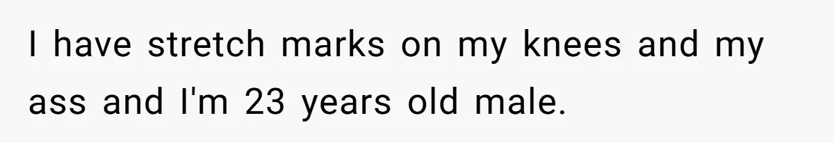I have stretch marks on my knees and my ass and I'm 23 years old male.