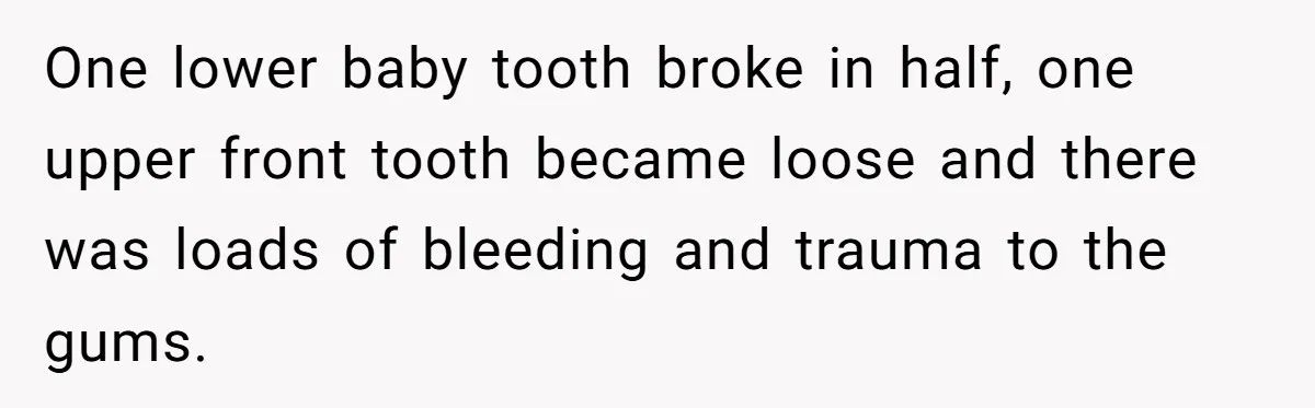 She Lost Her Temper After Her Husband Refused to Tell Her Where Their Injured Toddler Was Taken, and Now Everything Is Falling Apart One lower baby tooth broke in half, one upper front tooth became loose and there was loads of bleeding and trauma to the gums.
