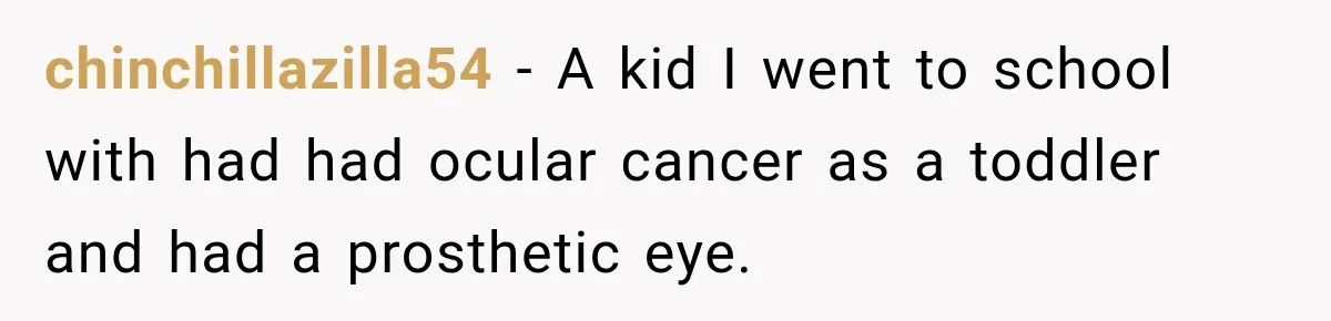 chinchillazilla54 − A kid I went to school with had had ocular cancer as a toddler and had a prosthetic eye.