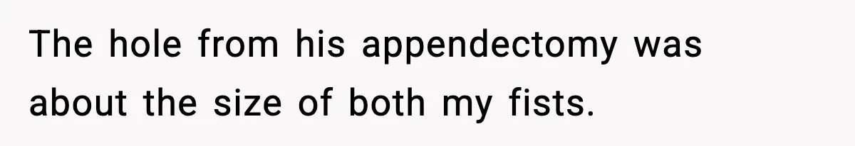 The hole from his appendectomy was about the size of both my fists.