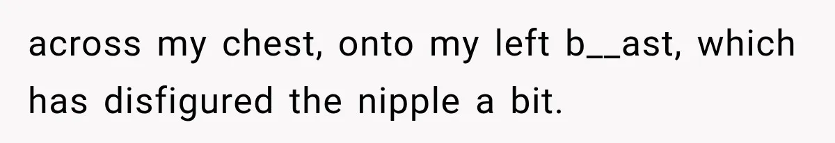across my chest, onto my left b__ast, which has disfigured the nipple a bit.