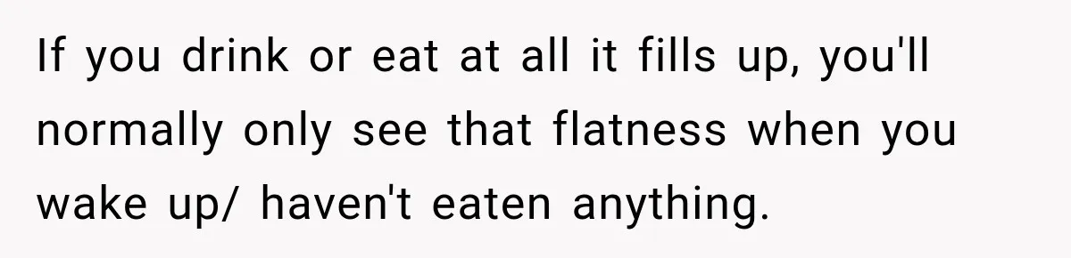 If you drink or eat at all it fills up, you'll normally only see that flatness when you wake up/ haven't eaten anything.