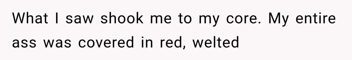 What I saw shook me to my core. My entire ass was covered in red, welted