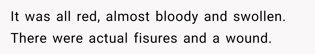 It was all red, almost bloody and swollen. There were actual fisures and a wound.