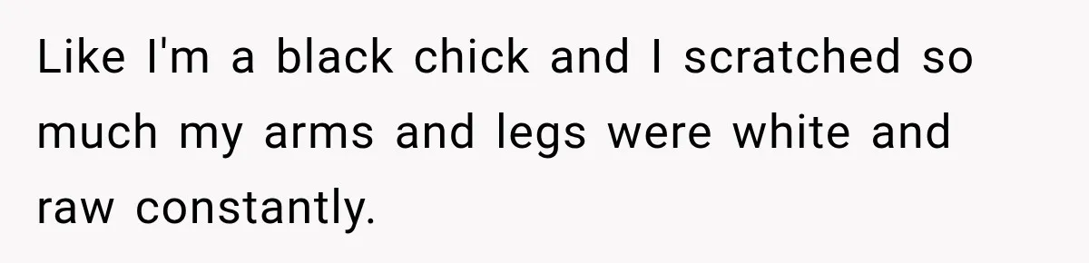 Like I'm a black chick and I scratched so much my arms and legs were white and raw constantly.