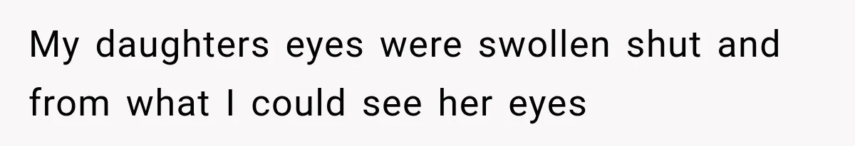 Grandmother Tells Allergic Granddaughter Mommy Doesn’t Love Her, Then Loses Access to the Kids My daughters eyes were swollen shut and from what I could see her eyes